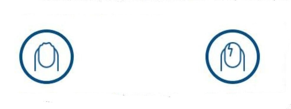 déformation des ongles due à une infection fongique